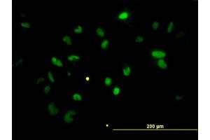 Immunofluorescence of monoclonal antibody to CHEK2 on HeLa cell. (CHEK2 抗体  (AA 1-543))