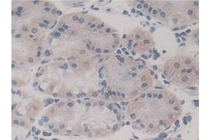 Detection of FIS1 in Human Stomach Tissue using Polyclonal Antibody to Fission 1 (FIS1)
