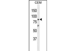 Western blot analysis of Z Antibody (N-term) (ABIN653866 and ABIN2843121) in CEM cell line lysates (35 μg/lane). (ZNF160 抗体  (N-Term))
