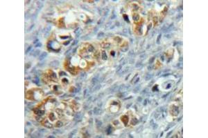 Used in DAB staining on fromalin fixed paraffin-embedded Ovary tissue (MCL-1 抗体  (AA 6-328))