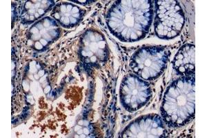 Detection of PKCe in Human Colon Tissue using Monoclonal Antibody to Protein Kinase C Epsilon (PKCe) (PKC epsilon 抗体  (AA 403-672))