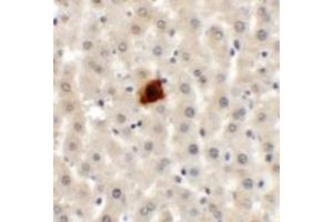 Immunohistochemistry (IHC) image for anti-Etoposide Induced 2.4 (EI24) (C-Term) antibody (ABIN1030379) (EI24 抗体  (C-Term))