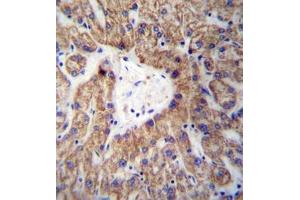 Immunohistochemistry analysis in formalin fixed and paraffin embedded human liver tissue reacted with GLYAT /  ACGNAT Antibody (Center) followed by peroxidase conjugation of the secondary antibody and DAB staining. (GLYAT 抗体  (Middle Region))