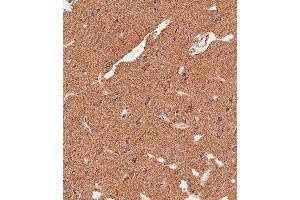 Immunohistochemical analysis of paraffin-embedded human brain tissue using (ABIN656416 and ABIN2845709) performed on the Leica® BOND RXm. (APG8b (AA 9-33), (N-Term) 抗体)