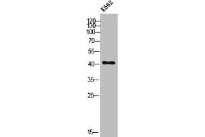 Western Blot analysis of K562 cells using ZnT-8 Polyclonal Antibody (SLC3A8 (Internal Region) 抗体)
