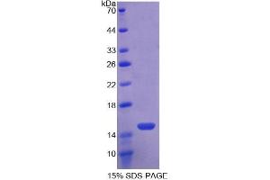 WB of Protein Standard: different control antibodies against Highly purified E. (TLR3 ELISA 试剂盒)
