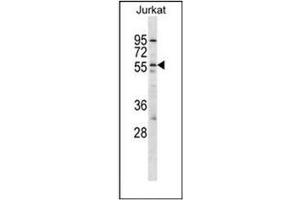 Western blot analysis of Orexin receptor type 2 Antibody (Center) in Jurkat cell line lysates (35ug/lane).