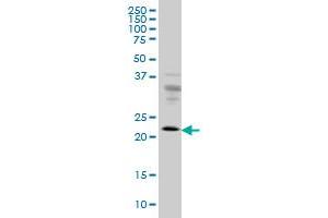 RAB9A monoclonal antibody (M01), clone 1E12 Western Blot analysis of RAB9A expression in HeLa . (RAB9A 抗体  (AA 17-115))