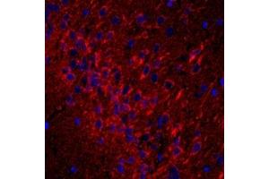 Immunofluorescent analysis of paraformaldehyde-fixed rat brain using,CD63 (ABIN7073400) at dilution of 1: 1500 (CD63 抗体)
