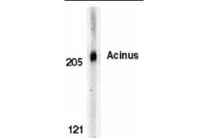 Western blot analysis of Acinus in K562 whole cell lysate with Acinus antibody (CT) at 0.