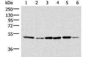 Western blot analysis of Jurkat PC-3 HepG2 Hela HT-29 and Raji cell lysates using IP6K1 Polyclonal Antibody at dilution of 1:400 (IP6K1 抗体)