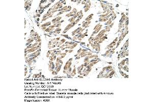 Immunohistochemistry (IHC) image for anti-Solute Carrier Family 6 (Neurotransmitter Transporter, Creatine), Member 8 (SLC6A8) (N-Term) antibody (ABIN2775317)