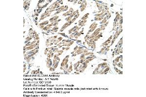Rabbit Anti-SLC6A8 Antibody  Paraffin Embedded Tissue: Human Muscle Cellular Data: Skeletal muscle cells Antibody Concentration: 4. (SLC6A8 抗体  (N-Term))