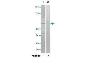 Western blot analysis of extracts from COLO 205 cells, using GRK1 polyclonal antibody . (GRK1 抗体)
