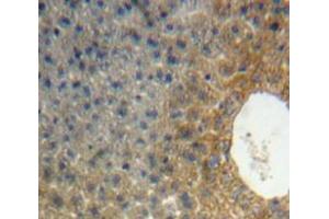 Used in DAB staining on fromalin fixed paraffin-embedded Liver tissue (APOH 抗体  (AA 20-297))