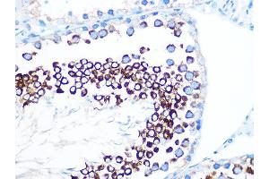 Immunohistochemistry of paraffin-embedded rat testis using FMRP Rabbit mAb (ABIN1679778, ABIN3019025, ABIN3019026 and ABIN7101703) at dilution of 1:100 (40x lens). (FMR1 抗体)