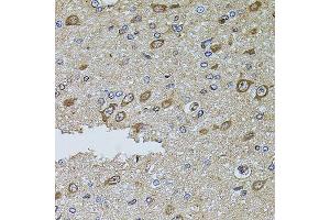 Immunohistochemistry of paraffin-embedded rat brain using MTIF3 antibody (ABIN5974622) at dilution of 1/100 (40x lens). (MTIF3 抗体)