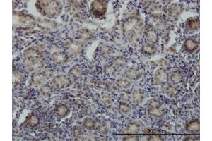 Immunoperoxidase of monoclonal antibody to STK38 on formalin-fixed paraffin-embedded human stomach. (STK38 抗体  (AA 365-465))
