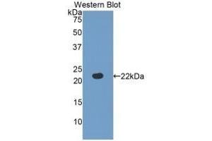 Detection of recombinant FBLN5 using Polyclonal Antibody to Fibulin 5 (FBLN5) (Fibulin 5 抗体  (AA 277-448))
