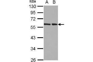 WB Image Sample (30 ug of whole cell lysate) A: 293T B: A431 12% SDS PAGE antibody diluted at 1:10000 (RAD23B 抗体  (Center))