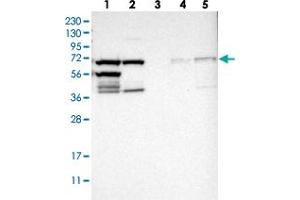 Western blot analysis of Lane 1: RT-4, Lane 2: U-251 MG, Lane 3: Human Plasma, Lane 4: Liver, Lane 5: Tonsil with TRIP4 polyclonal antibody . (TRIP4 抗体)