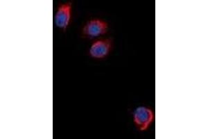 Immunofluorescent analysis of EPO Receptor staining in NIH3T3 cells. (EPOR 抗体)