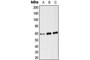 Western blot analysis of Angiopoietin-2 expression in Hela (A), Raw264. (Angiopoietin 2 抗体  (Center))