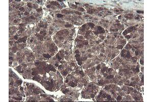 Image no. 11 for anti-TSC22 Domain Family, Member 1 (TSC22D1) antibody (ABIN1501540)