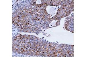 IHC analysis of TACI using anti-TACI antibody (ABIN5692816).