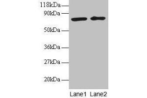Western blot All lanes: BLOC1S1 antibody at 2 μg/mL Lane 1: EC109 whole cell lysate Lane 2: 293T whole cell lysate Secondary Goat polyclonal to rabbit IgG at 1/15000 dilution Predicted band size: 18, 15 kDa Observed band size: 75 kDa (BLOC1S1 抗体  (AA 1-153))