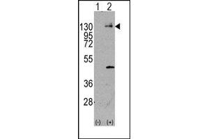 Image no. 1 for anti-Platelet Derived Growth Factor Receptor alpha (PDGFRA) (Tyr720) antibody (ABIN359908) (PDGFRA 抗体  (Tyr720))
