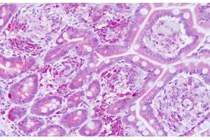 Image no. 2 for anti-KTI12 Homolog, Chromatin Associated (KTI12) (AA 170-219) antibody (ABIN6749797) (KTI12 抗体  (AA 170-219))