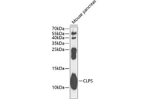 Western blot analysis of extracts of mouse pancreas, using CLPS antibody  at 1:1000 dilution. (CLPS 抗体  (AA 18-112))