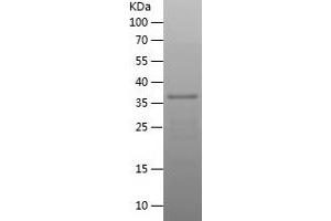 Western Blotting (WB) image for Thioredoxin-Related Transmembrane Protein 3 (TMX3) (AA 40-187) protein (His-IF2DI Tag) (ABIN7125369) (TMX3 Protein (AA 40-187) (His-IF2DI Tag))