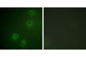 P-peptide - +Immunofluorescence analysis of COS-7 cells, using Integrin β1 (Phospho-Tyr789) antibody. (ITGB1 抗体  (pThr789))