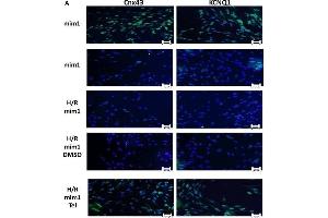 Telmisartan effects on hypoxic H9c2 cardiomyocytes transfected with miR-1 mimic. (KCNQ1 抗体  (AA 501-600))