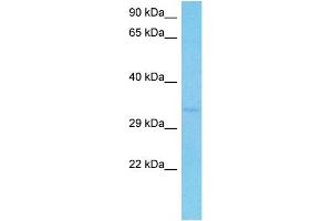 Western Blotting (WB) image for anti-Proteasome (Prosome, Macropain) 26S Subunit, Non-ATPase, 14 (PSMD14) (N-Term) antibody (ABIN2779653)