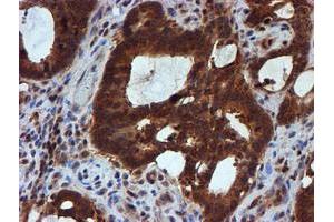 Image no. 3 for anti-Histidyl-tRNA Synthetase 2, Mitochondrial (Putative) (HARS2) antibody (ABIN1498584)