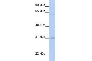 WB Suggested Anti-MARCH2 Antibody Titration:  0. (MARCH2 抗体  (Middle Region))