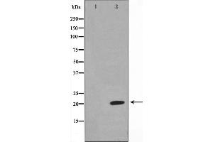 Western blot analysis on Jurkat cell lysate using Musculin Antibody,The lane on the left is treated with the antigen-specific peptide. (Musculin 抗体  (Internal Region))