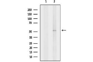 Western blot analysis of lysates from 293t, using CAP1 Antibody.