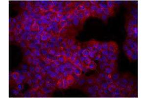 Immunofluorescence (IF) image for anti-Receptor tyrosine-protein kinase erbB-2 (ErbB2/Her2) antibody (ABIN2664604) (ErbB2/Her2 抗体)