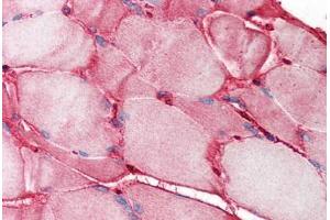 Human Skeletal Muscle (formalin-fixed, paraffin-embedded) stained with FN1 antibody ABIN214358 at 1. (Fibronectin 1 抗体)