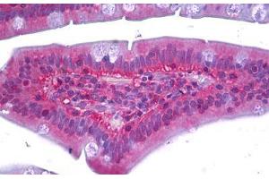 Anti-RAC1 antibody IHC staining of human small intestine. (RAC1 抗体)