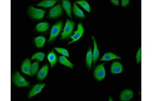 Immunofluorescence staining of A549 cells with ABIN7158336 at 1:100, counter-stained with DAPI. (LMCD1 抗体  (AA 105-268))