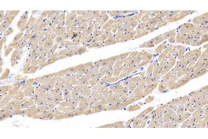Detection of cTnI in Human Cardiac Muscle Tissue using Polyclonal Antibody to Cardiac Troponin I (cTnI) (TNNI3 抗体  (AA 1-203))