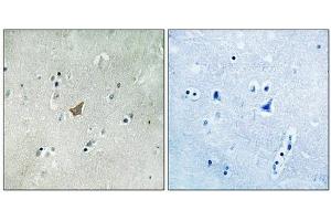 Immunohistochemical analysis of paraffin-embedded human brain tissue using EPHA3/4/5 (Phospho-Tyr779/833) antibody (left)or the same antibody preincubated with blocking peptide (right). (EPH Receptor A3 抗体  (pTyr779, pTyr833))