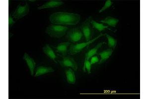 Immunofluorescence of monoclonal antibody to PBK on HeLa cell. (PBK 抗体  (AA 1-110))