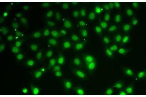 Immunofluorescence analysis of A-549 cells using HDAC5 Polyclonal Antibody