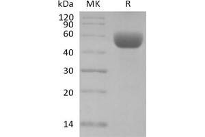 Western Blotting (WB) image for CD79b Molecule, Immunoglobulin-Associated beta (CD79B) protein (Fc Tag) (ABIN7320886) (CD79b Protein (Fc Tag))